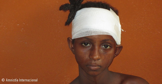 Fati, una niña de 11 años, con profundas heridas de machete en la cabeza y el brazo en un ataque de la milicia anti-balaka en Boali (al norte de...