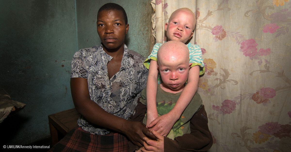 Dos niños albinos con su madre