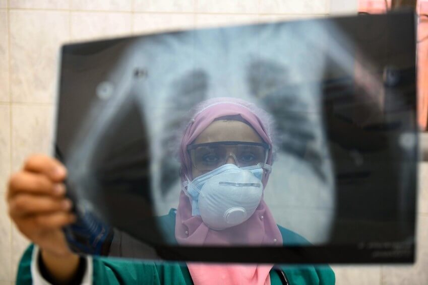 Una médica egipcia comprueba una radiografía de los pulmones de un paciente en la unidad de enfermedades infecciosas del hospital de Imbaba, en El Cairo, el 19 de abril de 2020, en medio de la pandemia del coronavirus. 