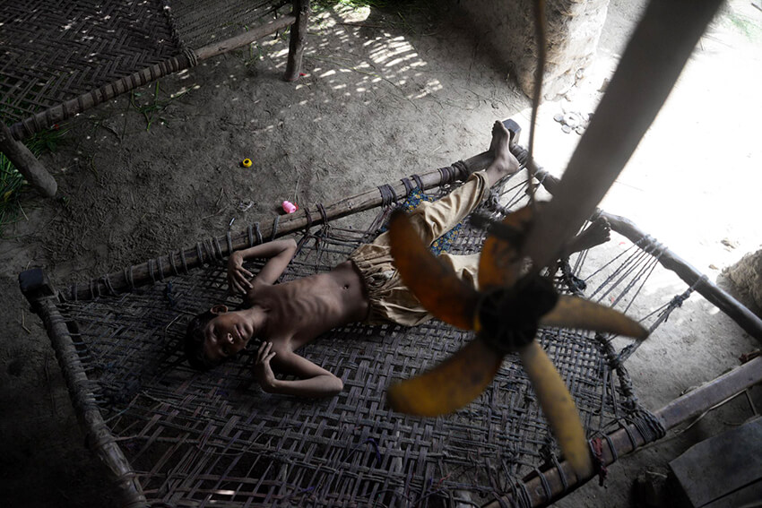 Un niño demacrado busca alivio bajo un ventilador solar