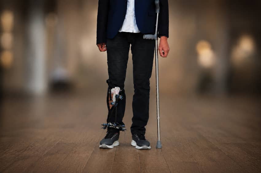 Hombre con muleta y un fijador externo en la pierna derecha tras resultar herido por un disparo en Gaza. La imagen ha sido editada digitalmente por motivos de seguridad.